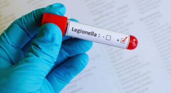 Allarme legionella nel milanese, cosa è successo? Sintomi, cause e cura
